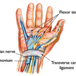 Carpal Tunnel