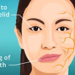 Using Massage Therapy to Treat Bell's Palsy - Medical Massage